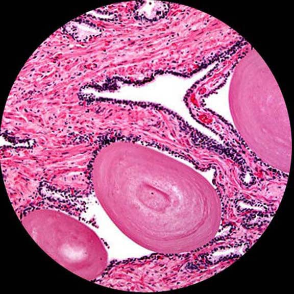 AmScope Binocular Compound Microscope